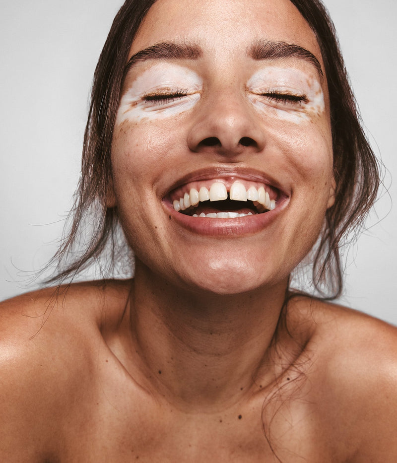 Routine anti-taches : le protocole idéal pour cibler l'hyperpigmentation