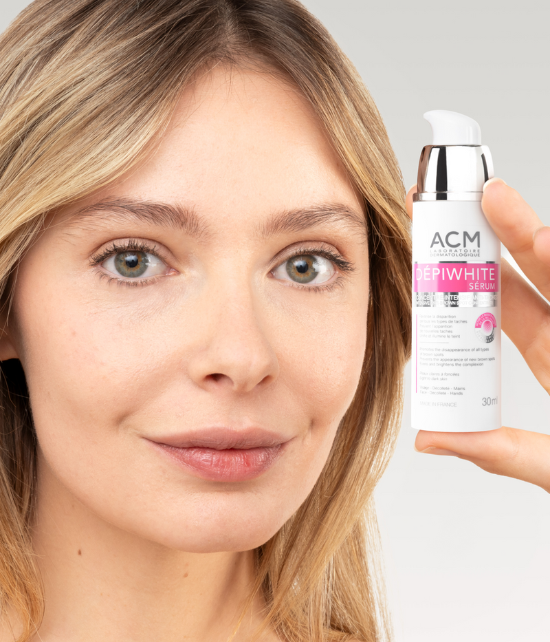 Hyperpigmentation – Quels sont les traitements les plus efficaces ?