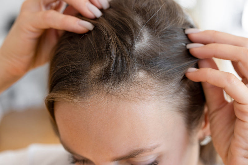 Quelles solutions pour une routine anti-chute de cheveux efficace ?