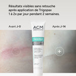 Trigopax Soin Protecteur et Apaisant