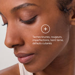 Azéane Crème 15% Acide Azélaïque