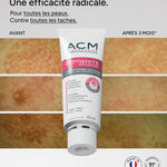Advanced Intensive Anti-Dark Spot Cream