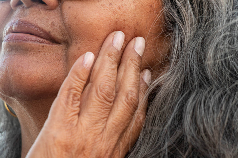 Taches de vieillesse (lentigos séniles) : causes et solutions pour les atténuer