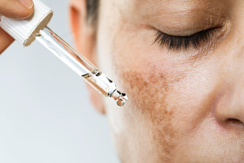 Sérum ou crème anti-taches : comment choisir selon son type de tache ?