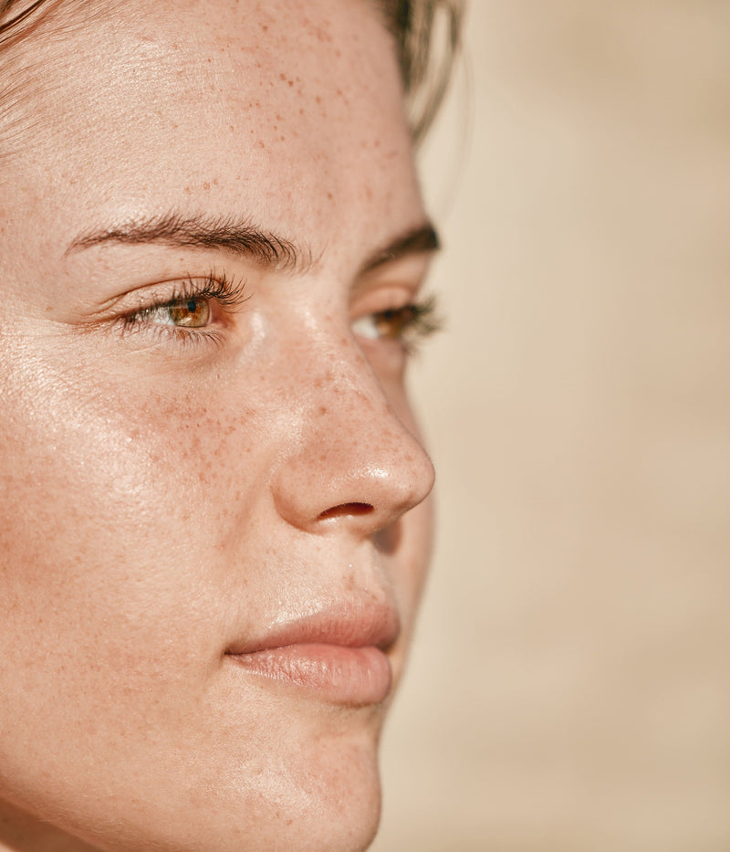 Comment se forment les taches pigmentaires ?