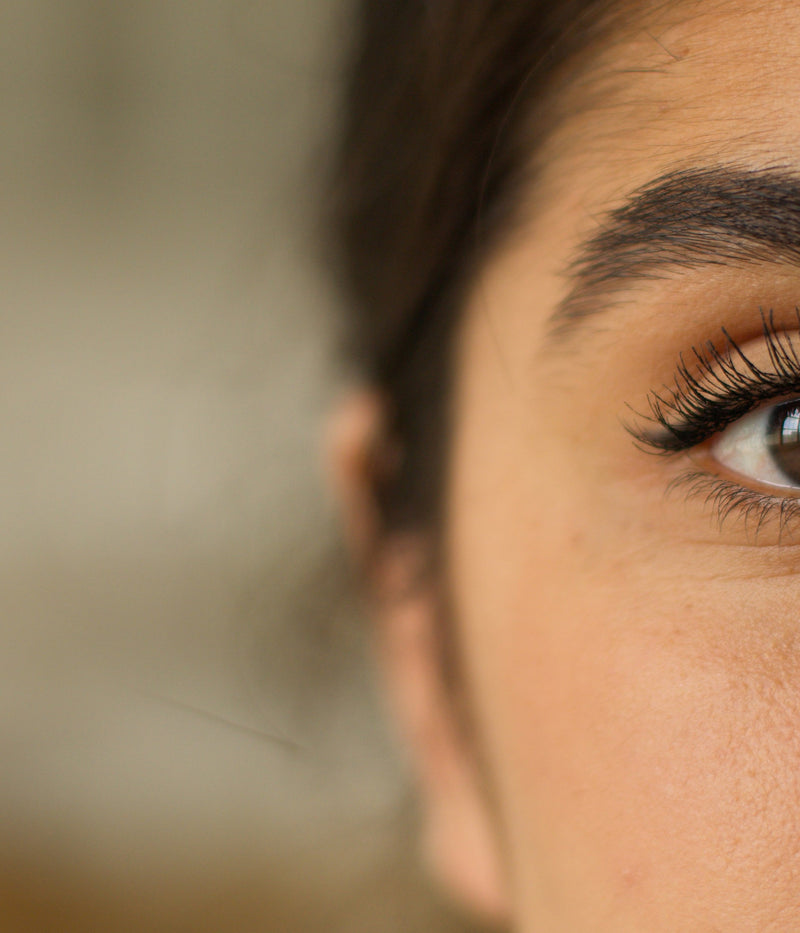 Comment reconnaître et traiter les cernes pigmentaires ?