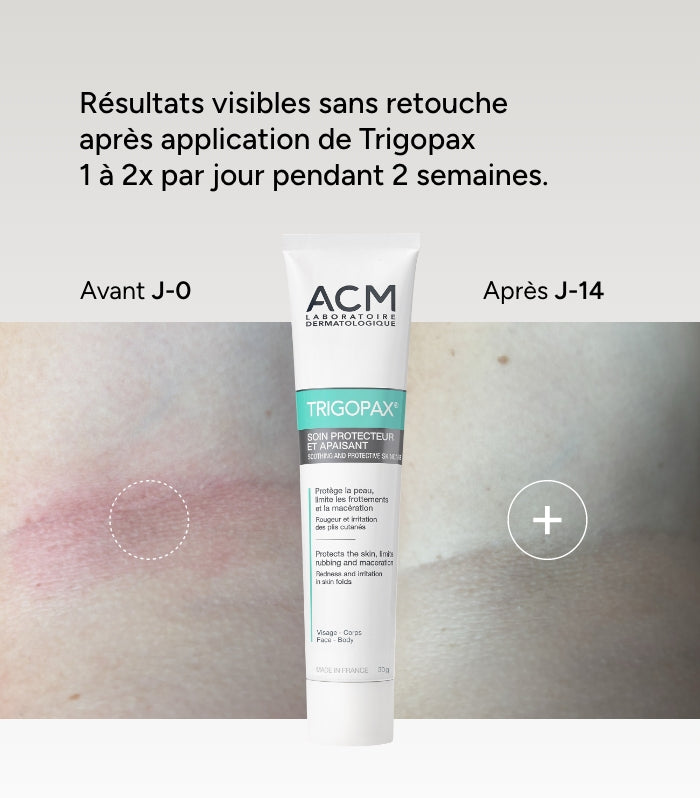 Protective and soothing care
