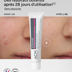 Azéane Crema 15% Ácido azelaico