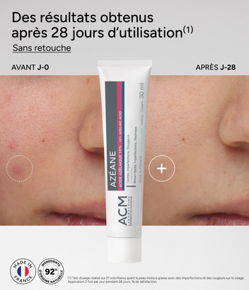 AZÉANE | Crema 15 % de ácido azelaico para todo tipo de pieles