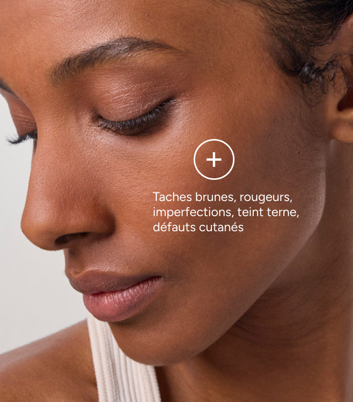 Azéane Crème 15% Acide Azélaïque