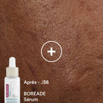 Boréade Sérum