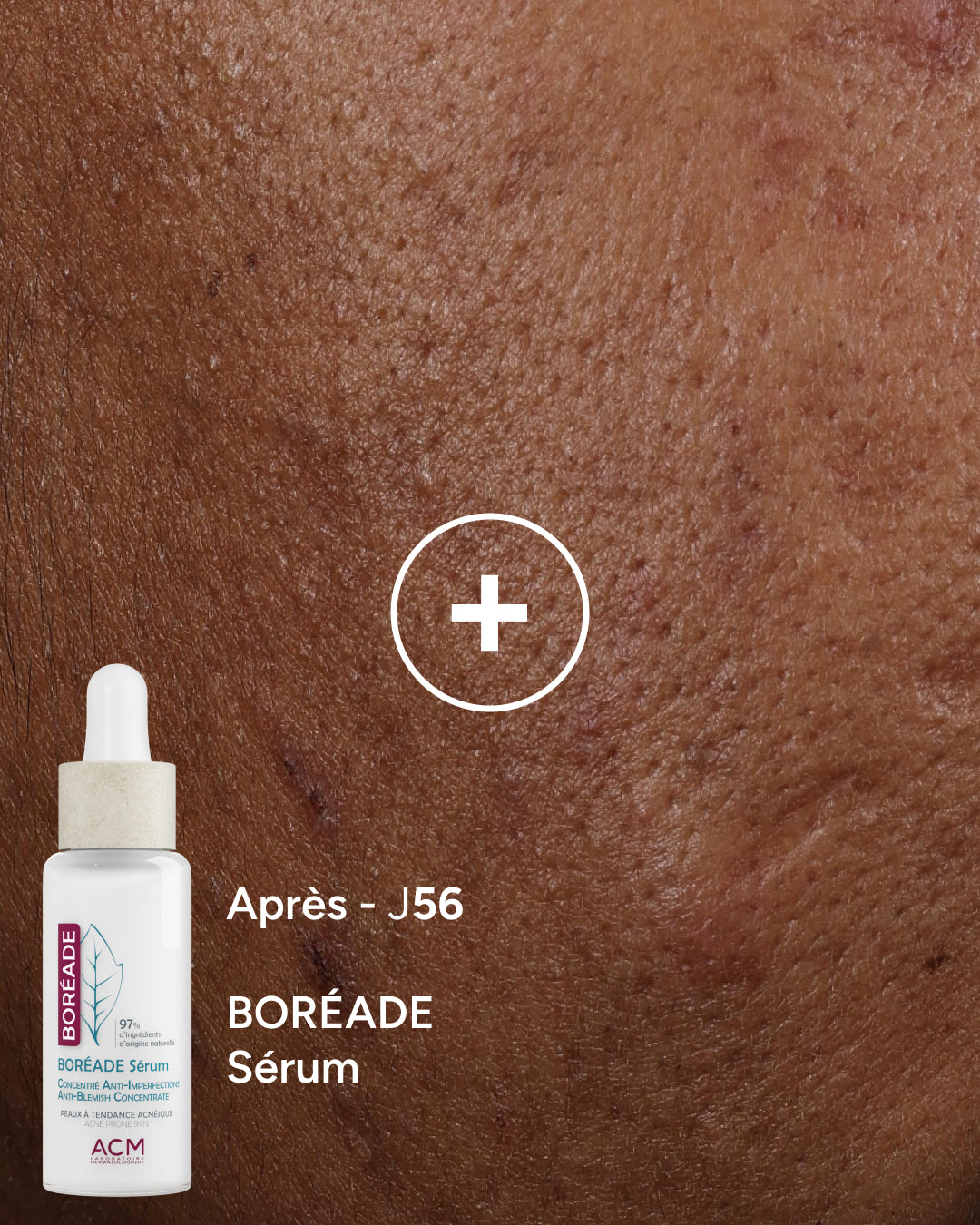 Boréade Sérum