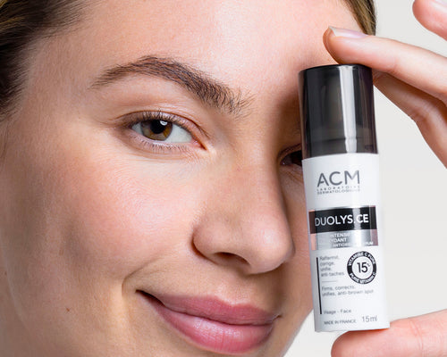 Hyperpigmentation