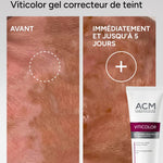 Viticolor complexion correcting gel